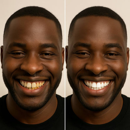 Flexienna™ Instant Whitening Pen